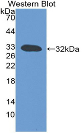 Western blot of recombinant Lymphotoxin-Beta / LTB.