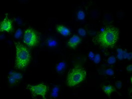 Anti-LOX mouse monoclonal antibody immunofluorescent staining of COS7 cells transiently transfected by pCMV6-ENTRY LOX.
