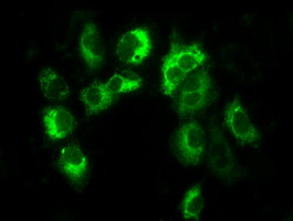 Anti-LOX mouse monoclonal antibody immunofluorescent staining of COS7 cells transiently transfected by pCMV6-ENTRY LOX.
