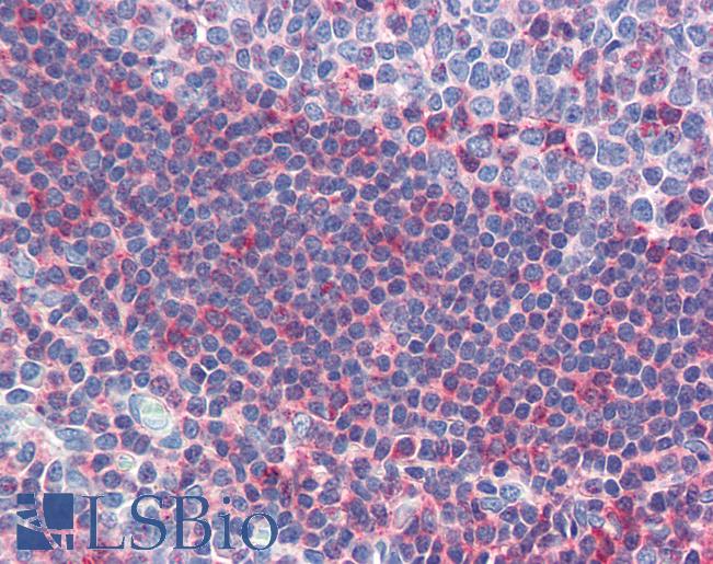 Anti-GSC antibody IHC of human tonsil. Immunohistochemistry of formalin-fixed, paraffin-embedded tissue after heat-induced antigen retrieval. Antibody LS-B3488 concentration 5 ug/ml.