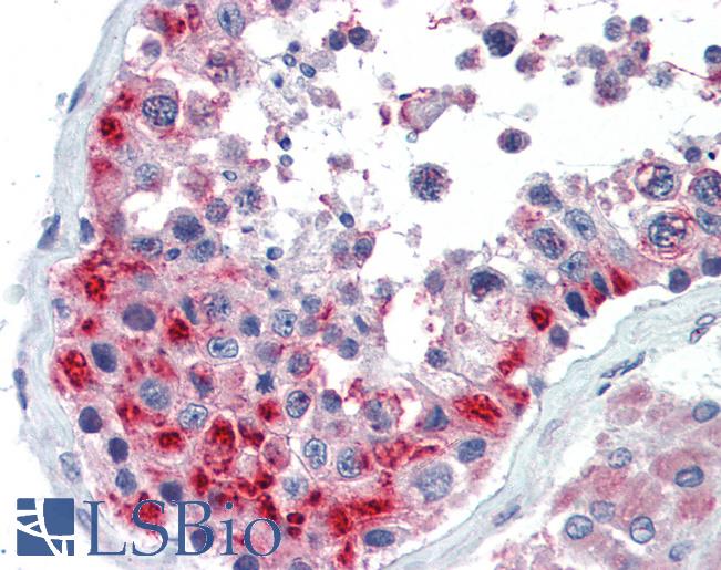 Anti-GSC antibody IHC of human testis. Immunohistochemistry of formalin-fixed, paraffin-embedded tissue after heat-induced antigen retrieval. Antibody LS-B3488 concentration 5 ug/ml.