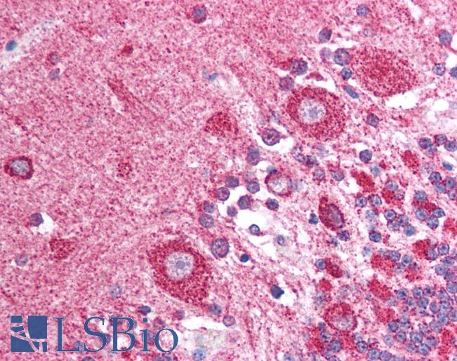 Anti-GOPC / PIST antibody IHC of human brain, cerebellum. Immunohistochemistry of formalin-fixed, paraffin-embedded tissue after heat-induced antigen retrieval. Antibody LS-B1356 concentration 5 ug/ml.