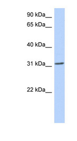 GSC antibody LS-B3488 Western blot of 721_B cell lysate.