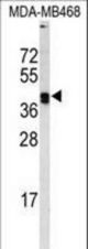 Western blot of LOX Antibody in MDA-MB468 cell line lysates (35 ug/lane). LOX (arrow) was detected using the purified antibody.