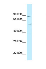 C3orf15 antibody LS-C145794 Western blot of Fetal Heart lysate. Antibody concentration 1 ug/ml.