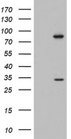 HEK293T cells were transfected with the pCMV6-ENTRY control (Left lane) or pCMV6-ENTRY C3orf15 (Right lane) cDNA for 48 hrs and lysed. Equivalent amounts of cell lysates (5 ug per lane) were separated by SDS-PAGE and immunoblotted with anti-C3orf15.