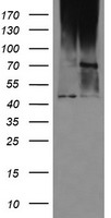 HEK293T cells were transfected with the pCMV6-ENTRY control (Left lane) or pCMV6-ENTRY C1orf161 (Right lane) cDNA for 48 hrs and lysed. Equivalent amounts of cell lysates (5 ug per lane) were separated by SDS-PAGE and immunoblotted with anti-C1orf161.