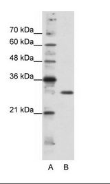 A: Marker, B: HepG2 Cell Lysate
