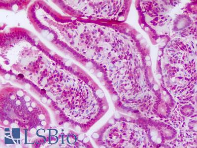 Anti-GSDMA antibody IHC of human small intestine. Immunohistochemistry of formalin-fixed, paraffin-embedded tissue after heat-induced antigen retrieval. Antibody LS-B8275 dilution 5-10 ug/ml.