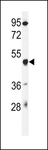 Western blot of GSDMA Antibody in mouse liver tissue lysates (35 ug/lane). GSDMA (arrow) was detected using the purified antibody.