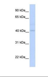 Fetal muscle lysate. Antibody concentration: 1.0 ug/ml. Gel concentration: 12%.