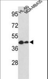 Western blot of GSDMB Antibody in HL-60, MDA-MB435 cell line lysates (35 ug/lane). GSDMB (arrow) was detected using the purified antibody.