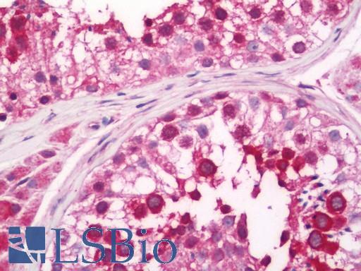 Human Testis: Formalin-Fixed, Paraffin-Embedded (FFPE)