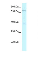 GSG2 antibody LS-C145606 Western blot of Placenta lysate. Antibody concentration 1 ug/ml.