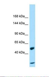 Western blot of Placenta. CCDC80 antibody dilution 1.0 ug/ml.
