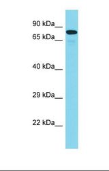 Western blot of Human Placenta. MAD1L1 antibody dilution 1.0 ug/ml.