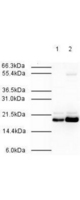 Anti-MAD2L2 Antibody - Western Blot. Affinity Purified Rabbit anti-MAD2L2 was used at a 1:500 dilution to detect human MAD2L2 by western blot. Both HeLa whole cell lysate (lane 1) and nuclear lysate (lane 2) were probed using this antibody. This antibody clearly detects a ~20 kD band corresponding to human MAD2L2 (predicted molecular weight is 24 kD). Approximately 20 ug of each lysate was loaded on a 10% SDS-PAGE. Primary antibody was reacted with the membrane at room temperature for 1 h. After subsequent washing, a 1:2000 dilution of HRP conjugated Gt-a-Rabbit IgG was used for visualization. Exposure time was 30 sec.