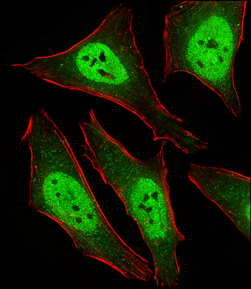 Fluorescent image of HeLa cells stained with MAD2L2 Antibody. Antibody was diluted at 1:25 dilution. An Alexa Fluor 488-conjugated goat anti-rabbit lgG at 1:400 dilution was used as the secondary antibody (green). Cytoplasmic actin was counterstained with Alexa Fluor 555 conjugated with Phalloidin (red).