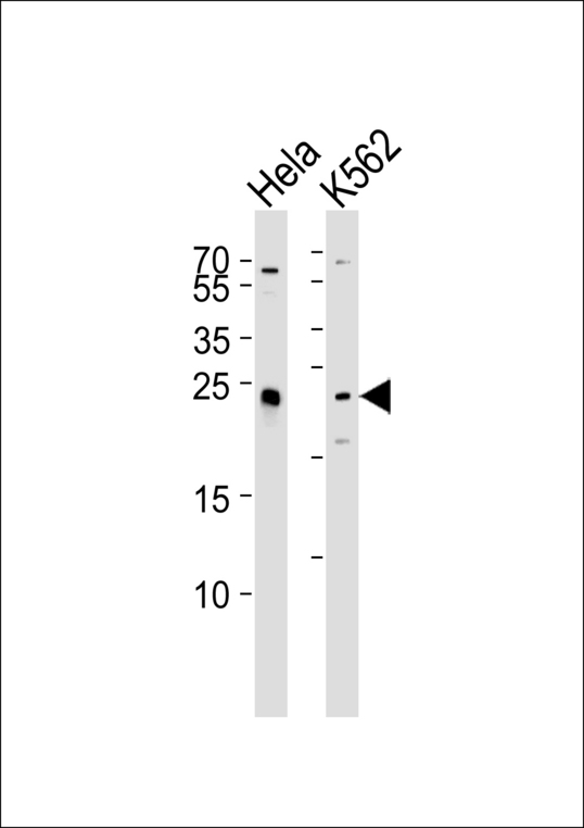 Western blot of lysates from HeLa, K562 cell line (from left to right) with MAD2L2 Antibody. Antibody was diluted at 1:1000 at each lane. A goat anti-rabbit IgG H&L (HRP) at 1:5000 dilution was used as the secondary antibody. Lysates at 35 ug per lane.
