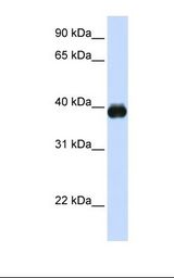 Placenta lysate. Antibody concentration: 1.0 ug/ml. Gel concentration: 12%.