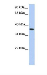 HepG2 cell lysate. Antibody concentration: 1.0 ug/ml. Gel concentration: 12%.