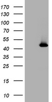 HEK293T cells were transfected with the pCMV6-ENTRY control (Left lane) or pCMV6-ENTRY MAGEA4 (Right lane) cDNA for 48 hrs and lysed. Equivalent amounts of cell lysates (5 ug per lane) were separated by SDS-PAGE and immunoblotted with anti-MAGEA4.
