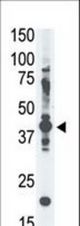 The anti-MAGE-A4 antibody is used in Western blot to detect MAGE-A4 in A375 cell lysate.