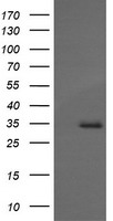 HEK293T cells were transfected with the pCMV6-ENTRY control (Left lane) or pCMV6-ENTRY MAGEA4 (Right lane) cDNA for 48 hrs and lysed. Equivalent amounts of cell lysates (5 ug per lane) were separated by SDS-PAGE and immunoblotted with anti-MAGEA4.