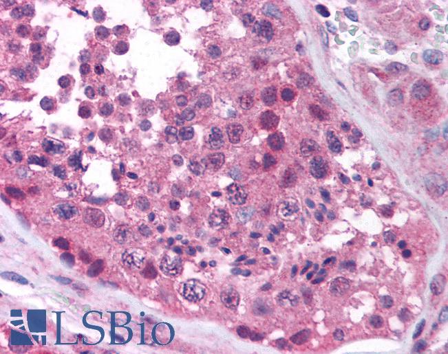 Anti-MAGEA4 antibody IHC of human testis. Immunohistochemistry of formalin-fixed, paraffin-embedded tissue after heat-induced antigen retrieval. Antibody LS-B885 concentration 10 ug/ml.