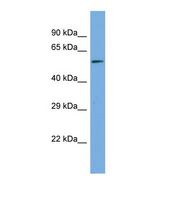 Western blot of Human HeLa. MAGED2 antibody dilution 1.0 ug/ml.