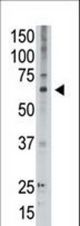 The anti-MAGED2 C-term Antibody is used in Western blot to detect MAGED2 in A549 lysate.
