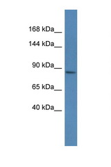 MAGEE1 antibody LS-C135449 Western blot of Mouse Spleen lysate. Antibody concentration 1 ug/ml.
