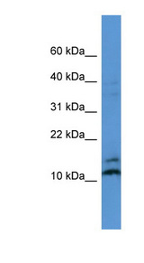 MAGOH antibody LS-C135763 Western blot of MCF7 cell lysate.