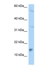 MAGOHB antibody LS-C145361 Western blot of A549 Cell lysate. Antibody concentration 1 ug/ml.