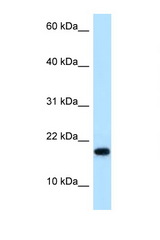 MAGOHB antibody LS-C145947 Western blot of HeLa Cell lysate. Antibody concentration 1 ug/ml.