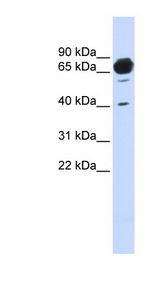 MAN1A2 / Alpha1 antibody LS-C102248 Western blot of Fetal Brain lysate.