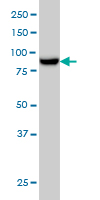 MAN1B1 monoclonal antibody (M01), clone 6B1 Western blot of MAN1B1 expression in A-431.