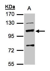 Sample (30 ug of whole cell lysate). A: Hep G2. 7.5% SDS PAGE. MANBA antibody diluted at 1:500
