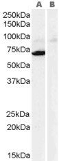Antibody (0.3 ug/ml) staining of human heart lysate (35 ug protein in RIPA buffer) with (B) and without (A) blocking with the immunizing peptide. Primary incubation was 1 hour. Detected by chemiluminescence.