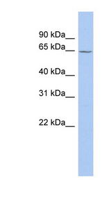 MAOA / Monoamine Oxidase antibody LS-C111792 Western blot of Fetal Liver lysate.
