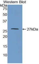 Western blot of recombinant MAOA / Monoamine Oxidase.