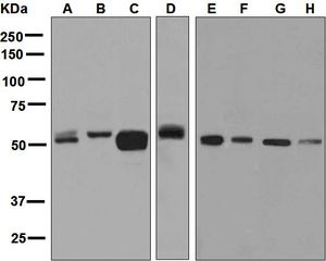 Western blot analysis on (A) fetal kidney, (B) human platelet, (C) fetal brain, (D) fetal liver, (E) 293T, (F) A549, (G) SH-SY5Y, and (H) HepG2 lysates using anti-MAO-B antibody.