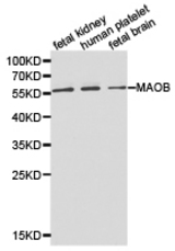 Western blot of extracts of various cell lines, using MAOB antibody.