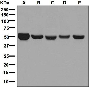 Western blot analysis on (A) fetal liver, (B) fetal kidney, (C) human platelet, (D) fetal brain, and (E) SH-SY5Y lysates using anti-MAOB antibody.