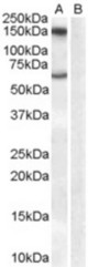 Antibody (1 ug/ml) staining of Human Brain lysate (35 ug protein in RIPA buffer) with (B) and without (A) blocking with the immunizing peptide. Primary incubation was 1 hour. Detected by chemiluminescence.