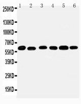 WB of MAOB / Monoamine Oxidase B antibody. All lanes: Anti-MAOB at 0.5ug/ml. Lane 1: Mouse Liver Tissue Lysate at 40ug. Lane 2: Mouse Lung Tissue Lysate at 40ug. Lane 3: Rat Kidney Tissue Lysate at 40ug. Lane 4: Rat Brain Tissue Lysate at 40ug. Lane 5: Rat Liver Tissue Lysate at 40ug. Lane 6: Rat Lung Tissue Lysate at 40ug. Predicted bind size: 59KD. Observed bind size: 59KD.