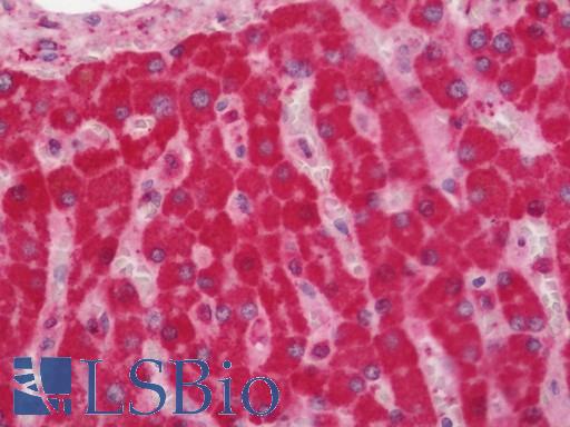 Human Liver: Formalin-Fixed, Paraffin-Embedded (FFPE)