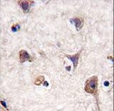 Formalin-fixed and paraffin-embedded human brain tissue reacted with Autophagy LC3 Antibody (APG8a) , which was peroxidase-conjugated to the secondary antibody, followed by DAB staining. This data demonstrates the use of this antibody for immunohistochemistry; clinical relevance has not been evaluated.
