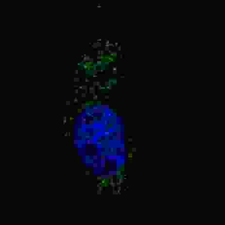 Fluorescent image of U251 cells stained LC3 (APG8A) antibody. U251 cells were treated with Chloroquine (50 mu M,16h), then fixed with 4% PFA (20 min), permeabilized with Triton X-100 (0.2%, 30 min). Cells were then incubated LC3 (APG8A) primary antibody (1:200, 2 h at room temperature). For secondary antibody, Alexa Fluor 488 conjugated donkey anti-rabbit antibody (green) was used (1:1000, 1h). Nuclei were counterstained with Hoechst 33342 (blue) (10 ug/ml, 5 min). LC3 immunoreactivity is localized to autophagic vacuoles in the cytoplasm of U251 cells.
