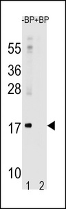 Western blot of anti-LC3 (APG8a) antibody in rat brain lysate. Both lipidated (arrow, II) and non-lipidated APG8a (arrow, I) were detected in membrane fraction (P) but only non-lipidated LC3 was detected in soluble fraction (S).